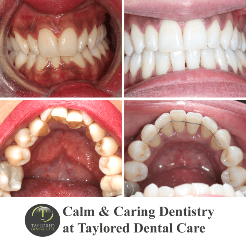 Changing smiles at Taylored Dental